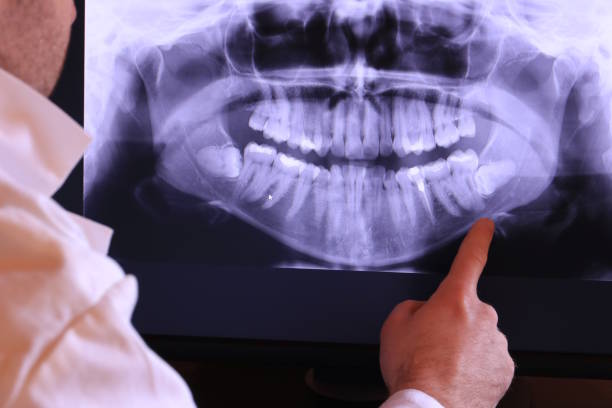 Best Emergency Treatment for Oral Infections in Palmyra, WI