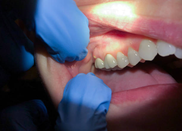 Best Emergency Pediatric Dental Care in Palmyra, WI