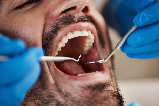 Best Walk-In Emergency Dental Services in Palmyra, WI